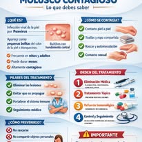 Servicios de Aureos