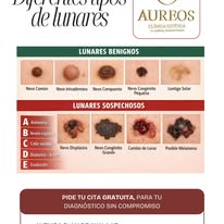 Acrocordones