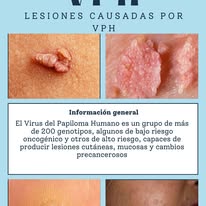 Información de quistes